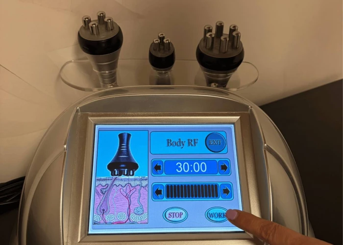 Radiofrequenza Viso e Corpo